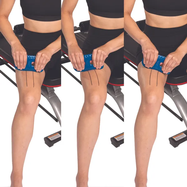FLEXEDGE MOBILIZER